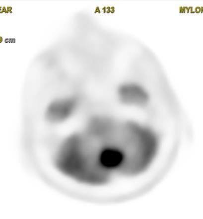 PET/CT: