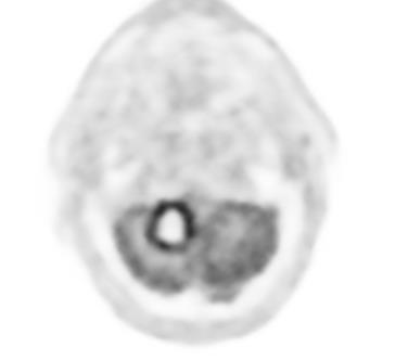 PET/CT: