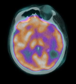 PET/CT: