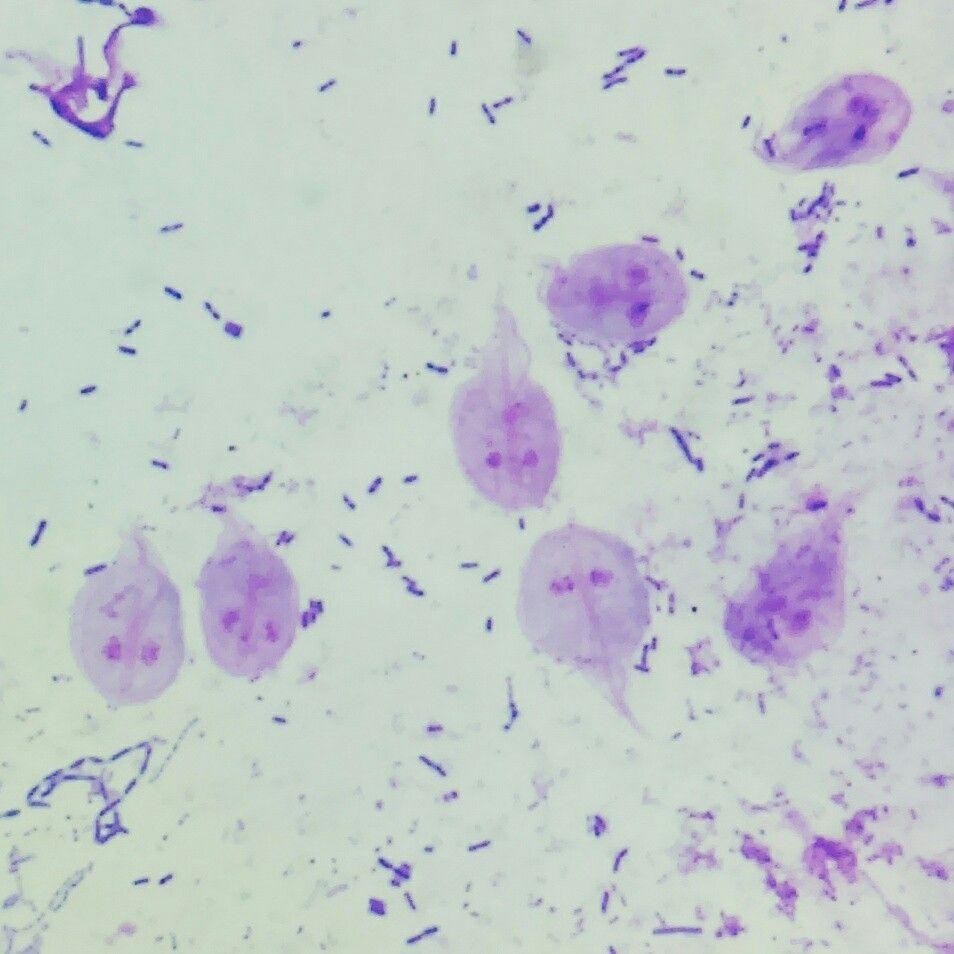 Giardia lamblίa με ELISA στα κόπρανα (ευαισθησία 85-98%, ειδικότητα 90-100%) o έμμεσα με