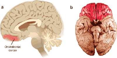 3 μετωποκογχικός φλοιός NEUROCOGNITIVE SYSTEM No 3: WANTING