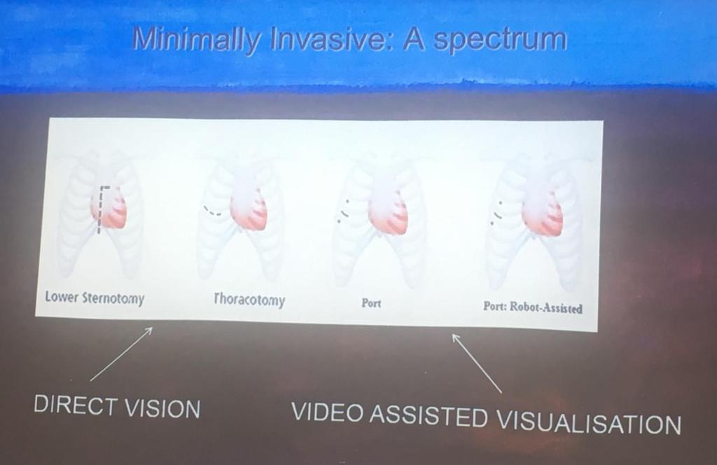 Minimally Invasive