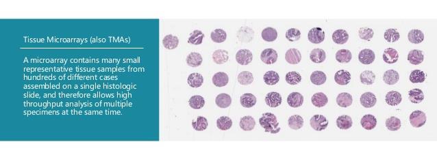 Tissue Microarrays Επιτρέπει την ταυτόχρονη ανάλυση μοριακών στόχων σε επίπεδο DNA, RNA ή πρωτεΐνης σε ιστούς από βιοψίες ασθενών με αυτοματοποιημένο τρόπο Σε