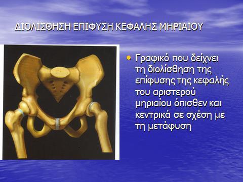 είναι η οστεονέκρωση και η χονδρόλυση και μπορεί να υπάρξει μόνιμη δυσλειτουργία.