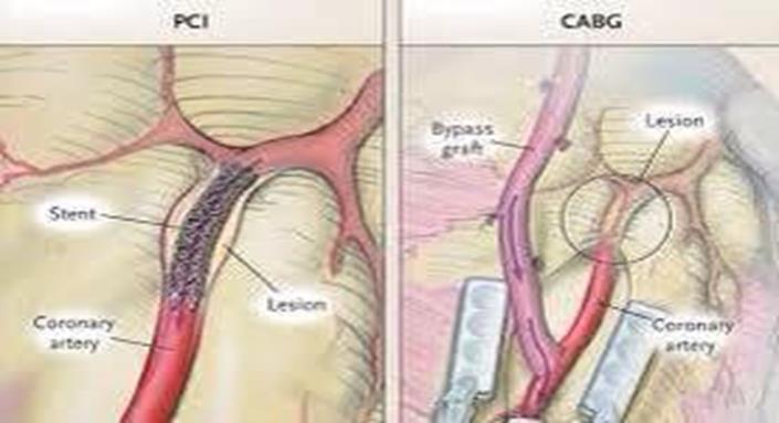 Patients Receiving Dialysis: Systematic