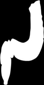 2006 (N=918) 1 Proctitis Left-sided