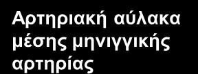 προςκίου κλάδου μζςθσ μθνιγγικισ αρτθρίασ (1 ου