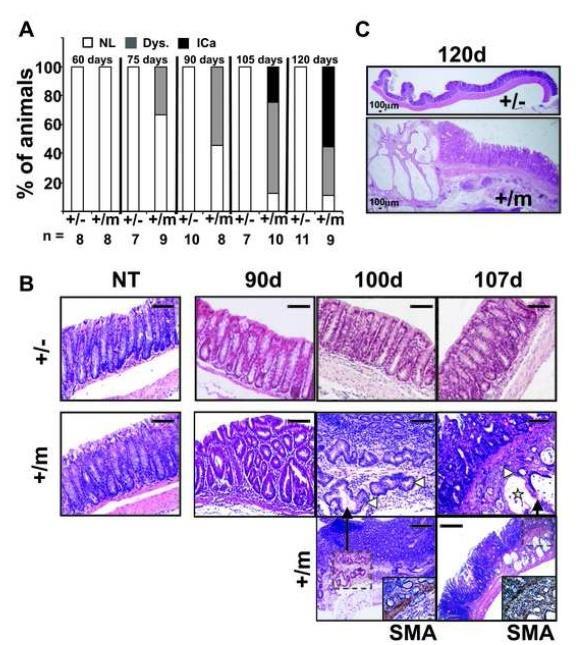 Mutp53 mice are highly prone