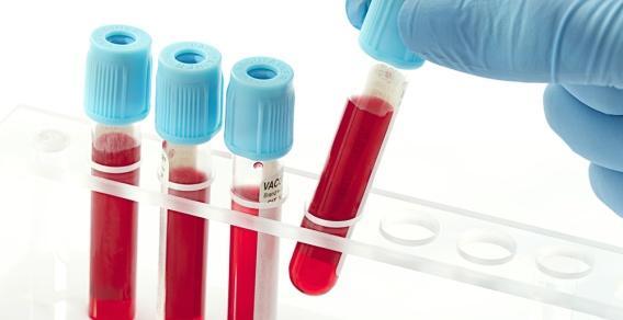 Τρόποι αντιμετώπισης (1) In vitro δοκιμασίες :Σημαντικές προσπάθειες βρίσκονται σε εξέλιξη για την ανάπτυξη in vitro δοκιμασιών και συστημάτων αφαίρεσης των μολυσματικών παραγόντων από το αίμα και τα