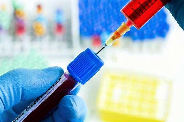 ΑΡΓΗ ΤΙΤΛΟΠΟΙΗΣΗ ΌΧΙ EPS και όψιμη
