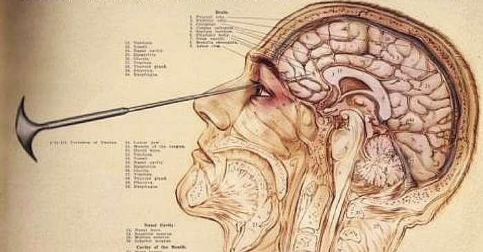 (E Moniz - Am J Psychiatry, 1937)