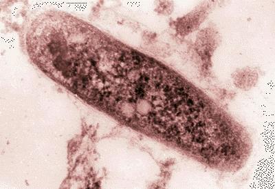 TB είναι χρόνια νόσος με αιτιολογικό παράγοντα το Mycobacterium tuberculosis Αλλά και