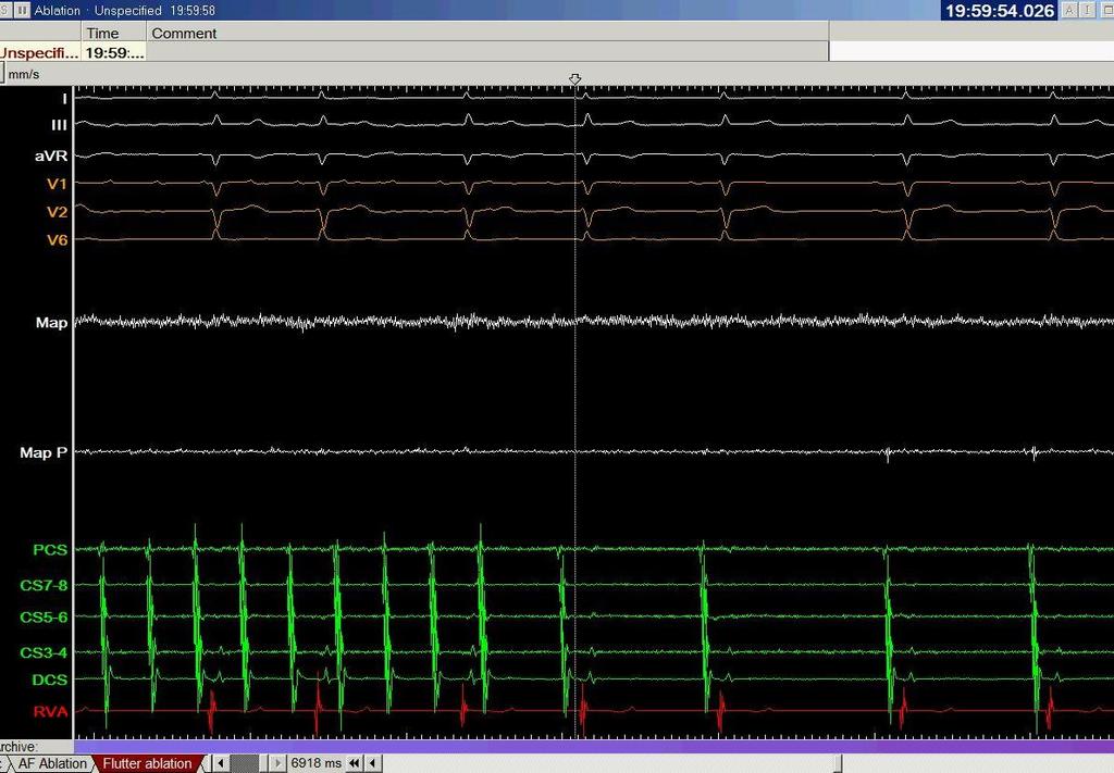 Anterior line