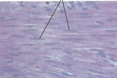 Μυϊκός ιστός Ιστοί Λείος Μη γραμμωτός μυς που απαντάται και στα απόνδυλα, στα οποία χρησιμεύει ως μυϊκό