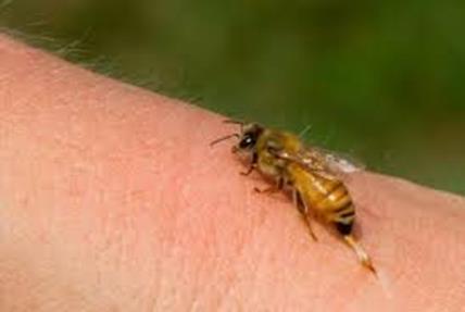 ΤΣΙΜΠΗΜΑ ΜΕΛΙΣΣΑΣ - ΣΦΙΓΓΑΣ Το τσίμπημα μέλισσας ή σφίγγας είναι επικίνδυνο σε αλλεργικά άτομα Πολτός μαγειρικής σόδας ανακουφίζει από κνησμό τσιμπήματος μέλισσας Ξύδι ή λεμόνι ανακουφίζει