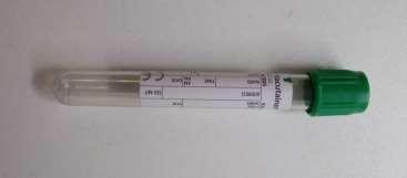 biomarkers of TB infection