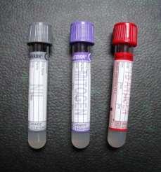 IFN-g-releasing cells