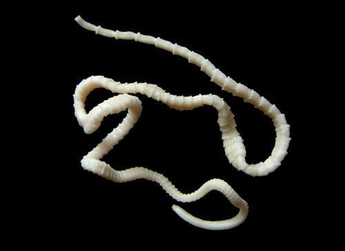 Βασίλειο: Animalia Φύλο: Platyhelminthes Κλάση Cestoda