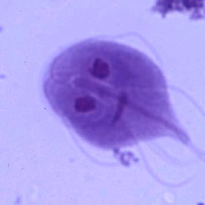 Giardia intestinalis (G. lamblia, G.
