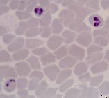 Φύλο: Apicomplexa Κλάση: Sporozoea Υποκλάση: Piroplasmidia