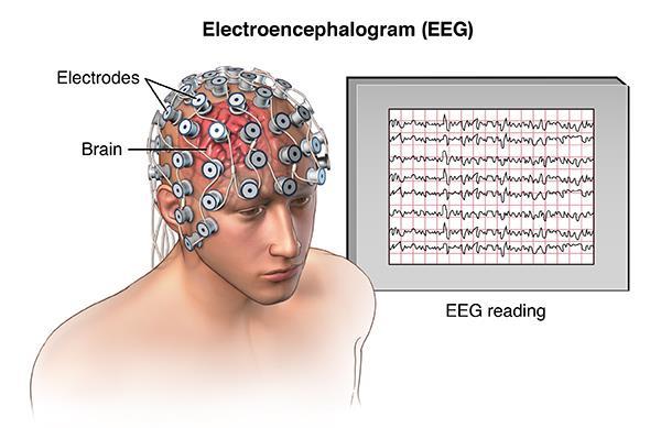 Εγκέφαλος και νευρικό σύστημα - Ηλεκτροεγκεφαλογράφος: - Ο ηλεκτροεγκεφαλογράφος είναι ένα σύστημα μέσω του οποίου μπορούμε να μετρήσουμε τα ηλεκτρικά σήματα που παράγονται στον εγκέφαλο - Καταγράφει