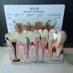 Παραστατικό μοντέλο που απεικονίζει τα δόντια με τις συνηθέστερες παθήσεις τους. Ιδανικό για εκπαιδευτικούς σκοπούς.