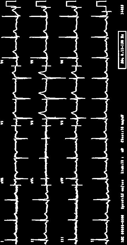 /EKG Τυπικό