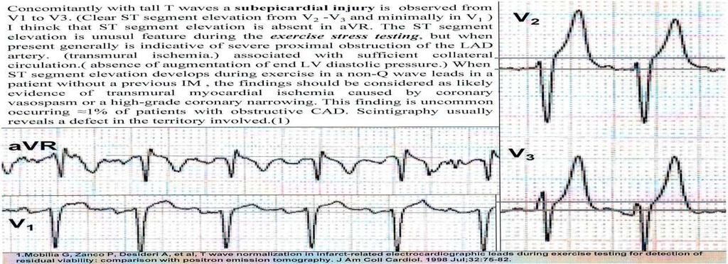 ΒΙΒΛΙΟΓΡΑΥΙΑ JACC