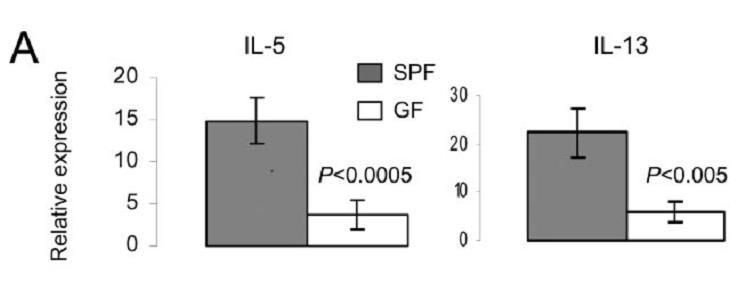 Th2/pro-fibrotic responses in SAMP1/Yit ileitis depend on microflora >20-wk-old