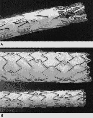 δύο stent.