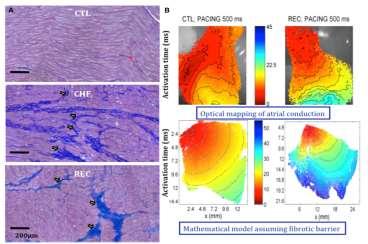 Fibrosis plays a key-role in the pathophysiology of AF How fibrosis contribute to