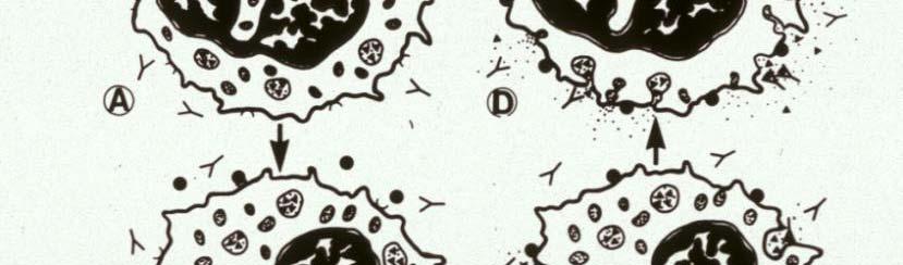 Wegener s granulomatosis Microscopic