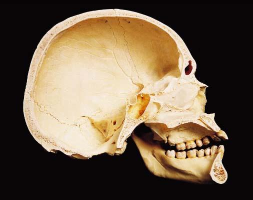 vault and the base Internally, prominent bony