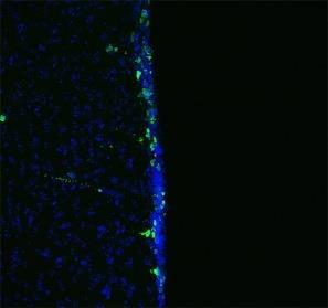 cells per SVZ