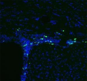 επάγει in vivo