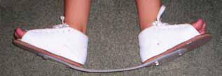 S; Uganda Sustainable Clubfoot