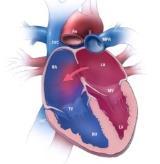 dissections, arteritis, etc) 25%