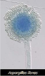 Μυκοτοξίνες Αφλατοξίνες (Aspergillus) Ωχρατοξίνες (Aspergillus & Penicillium) Τριχοθεκένια