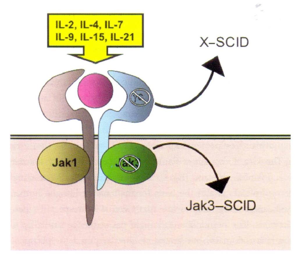 SCID (T-B+λεμφοκυτταρικός φαινότυπος)