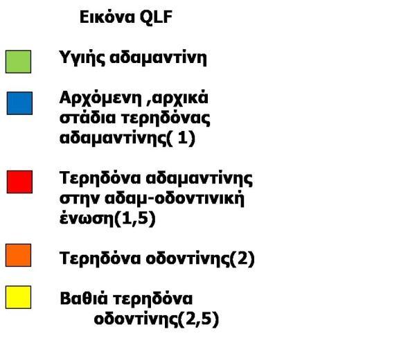 που βρίσκεται στην οθόνη του υπολογιστή.