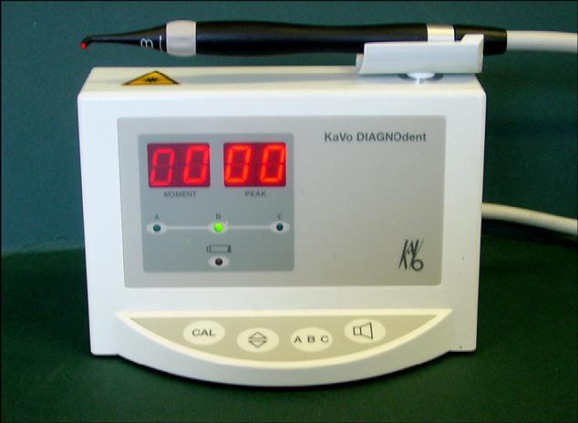 Το DIAGNOdent δημιουργήθηκε το 1998 (Hibst 1998, Koning 1998, Aljehami 2004) σαν βοηθητικό μέσο στην κλασσική εξέταση οπτικής ανίχνευσης αλλά και για την ποσοτικοποίηση των τερηδόνων που εντοπίζονται