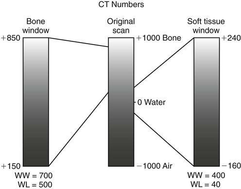 Εύρος τιμών HU Τεχνική παραθύρου Window Technique Εύρος παραθύρου Window Width - WW : Ο αριθμός των HU που θα απεικονισθούν στη συγκεκριμένη εικόνα.