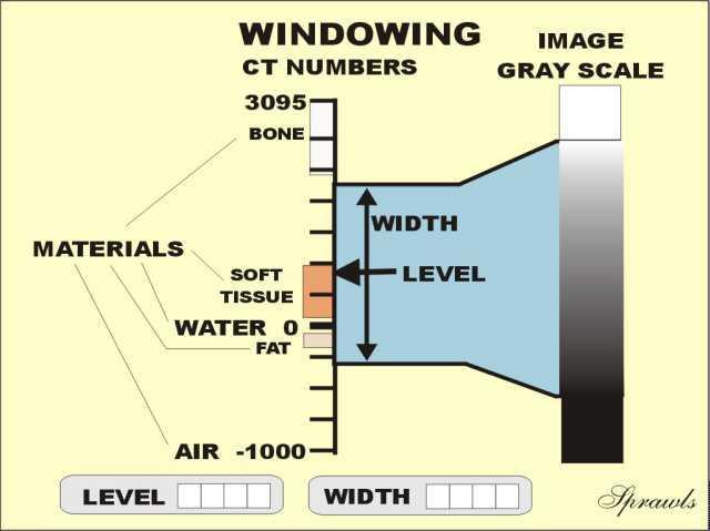 Εύρος τιμών HU Τεχνική παραθύρου Window Technique Εύρος παραθύρου Window Width - WW : Ο αριθμός των HU που θα απεικονισθούν στη συγκεκριμένη εικόνα.