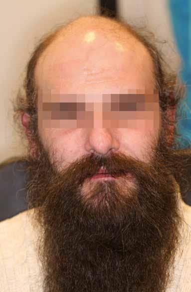 56 Εικ1β χεια λήφθηκε ένα αποτύπωμα της κατάστασης και στάλθηκε σε εμάς. Το πρώτο μας βήμα ήταν να κάνουμε λήψη ψηφιακών δεδομένων από την κατάσταση του ασθενή.