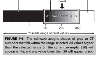 CTnumbers μεγαλύτεροι του επιλεγμένου εύρους απεικονίζονται ως άσπρο (στην κλίμακα του γκρι), ενώ αυτοί με τιμές μικρότερες του συγκεκριμένου εύρους