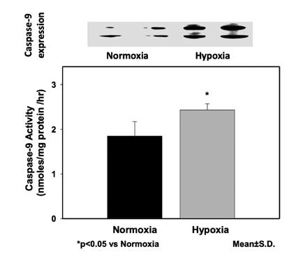Biochemical basis of hypoxic-ischemic encephalopathy in the newborn Figure 3. Activity and expression of Caspase-9 in the cerebral cortex of newborn piglets.
