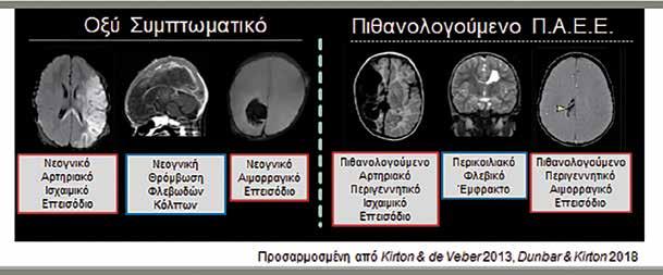 Εγκεφαλικό αγγειακό επεισόδιο στα νεογνά Εγκεφαλικό αγγειακό επεισόδιο στα νεογνά Δρ Ελένη Ν. Σκουτέλη Παιδονευρολόγος, Σύμβουλος ΜΕΝΝ ΜΗΤΕΡΑ hskouteli@yahoo.co.