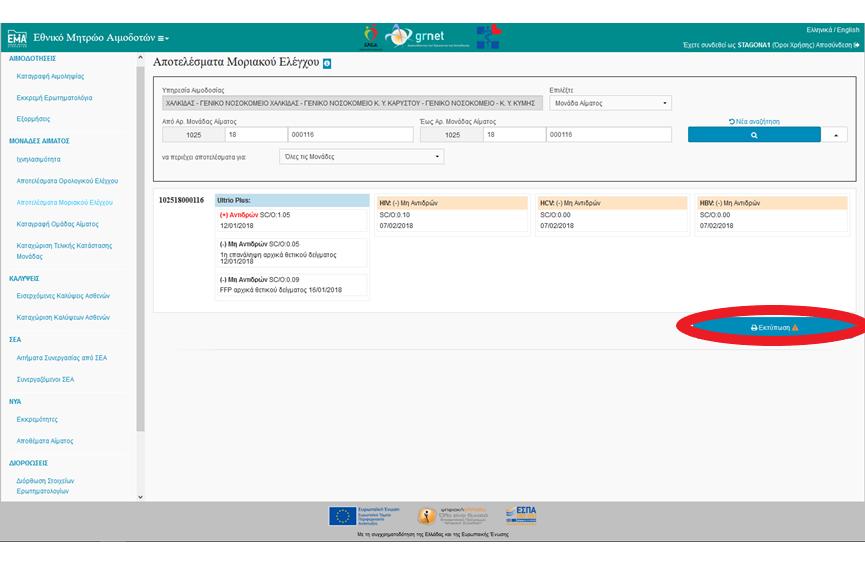 Εγχειρίδιο Χρηστών Υπηρεσίας Αιμοδοσίας Σελ. 84 Εικόνα 79: Εκτύπωση Αποτελεσμάτων 5.