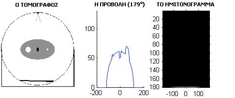 Λήψη Δεδομένων Ημιτονόγραμμα (sinogram) = Το διδιάστατο σύνολο των