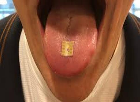 LSD(Lysergic acid diethylamide) To διαιθυλαμίδιο του λυσεργικού οξέος (Lysergic acid diethylamide), γνωστό περισσότερο